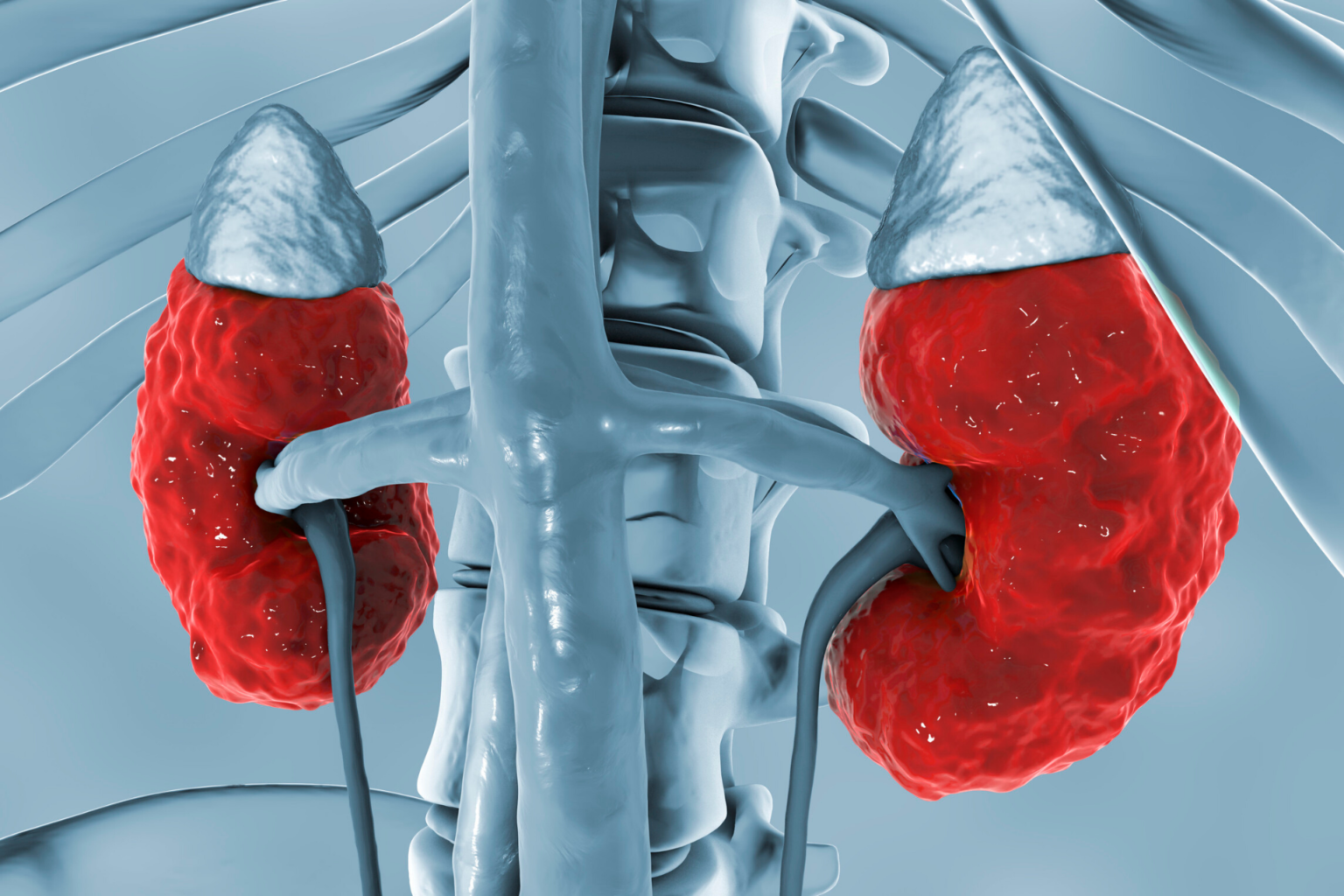 Can I Reverse CKD? | RenalTracker Blog