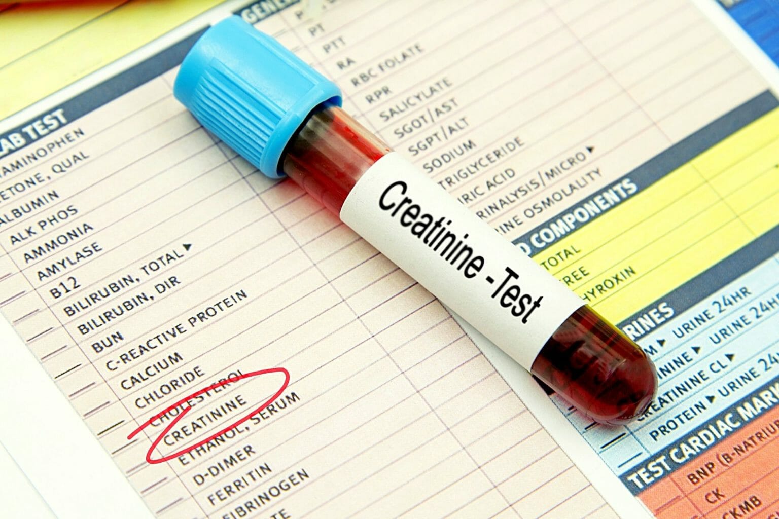 How To Improve Low Creatinine Levels