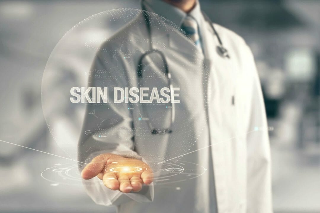 skin disease write up