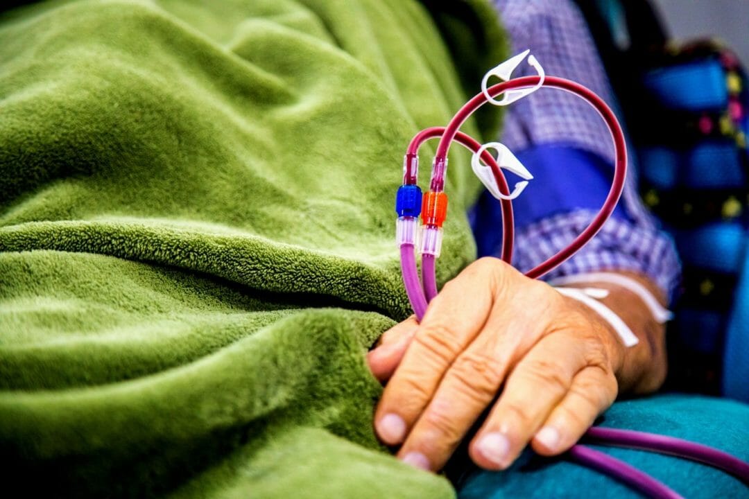 dialysis patient in bed getting dialysis