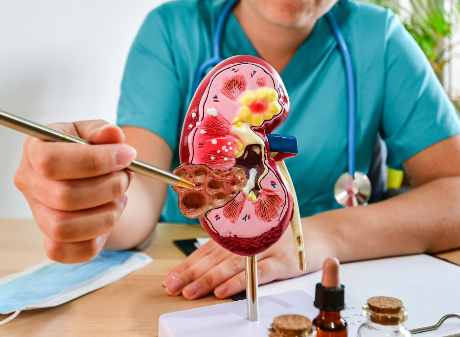 A nurse is working on a model of a kidney.