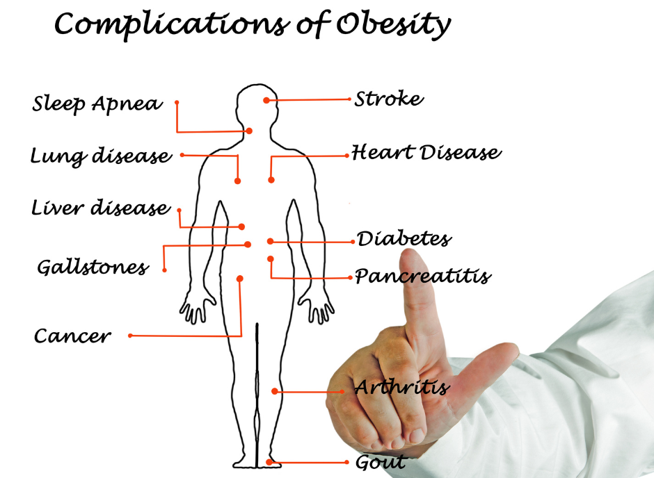 The complications of obesity.